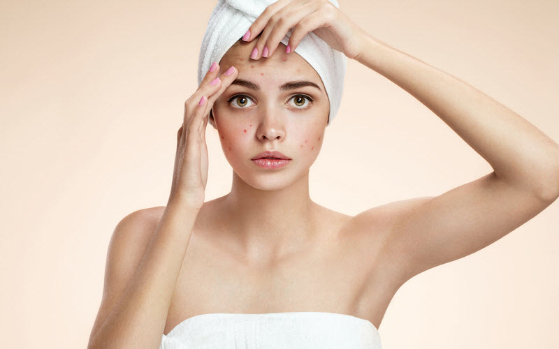 5 Ways To Get Rid Of Acne Scars